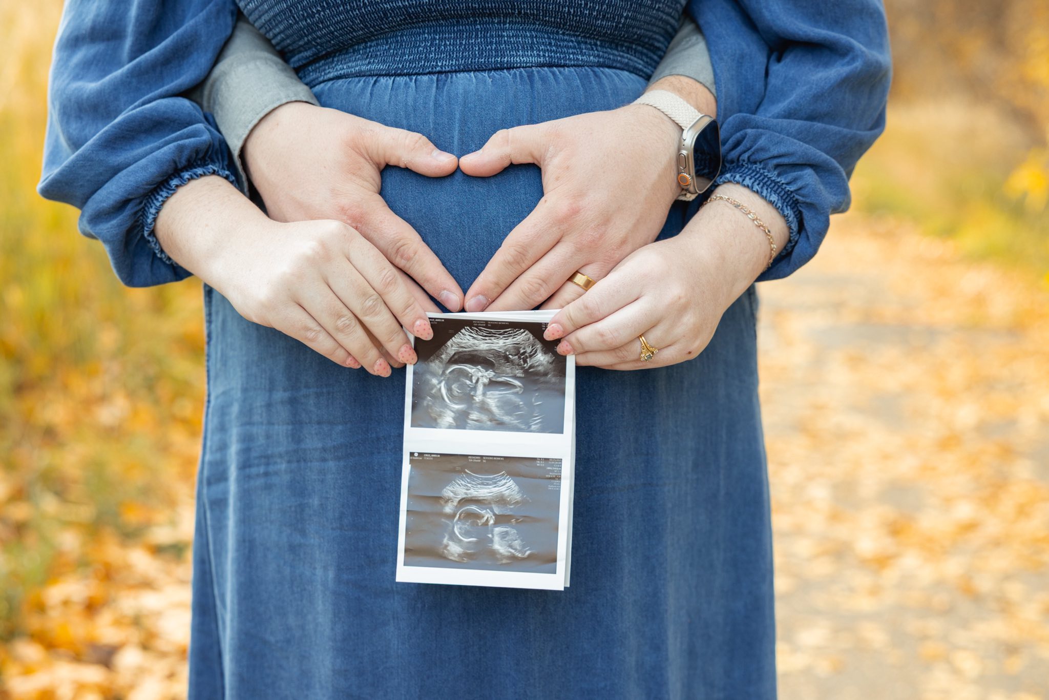 Image showing ultrasound images of the baby overtop of mom'a belly